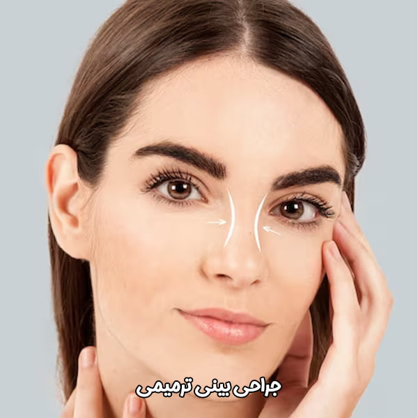 جراحی ترمیمی بینی در تهران - دکتر هاتفی