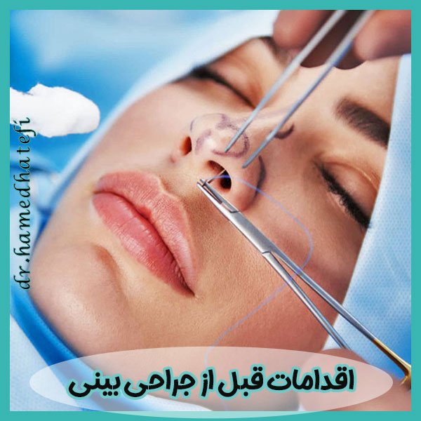 اقدامات قبل از جراحی بینی
