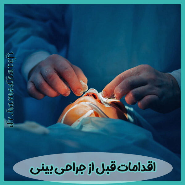 اقدامات قبل از جراحی بینی

