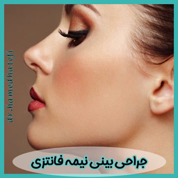 جراحی بینی نیمه فانتزی