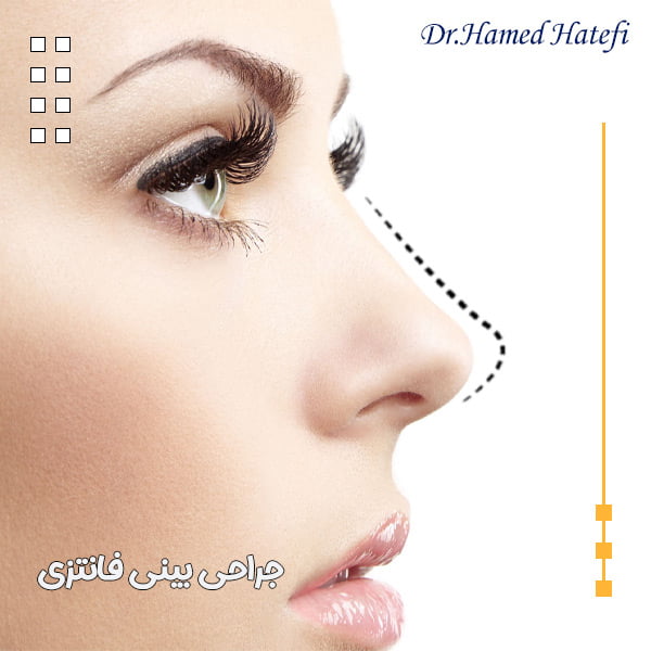 جراحی بینی فانتزی - دکتر حامد هاتفی