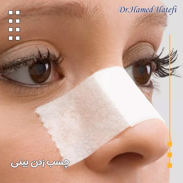 چسب زدن بینی - دکتر حامد هاتفی