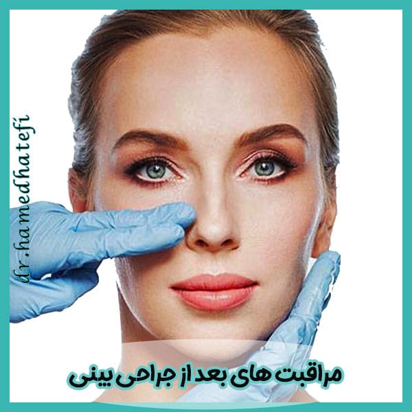 مراقبت های بعد از جراحی بینی
