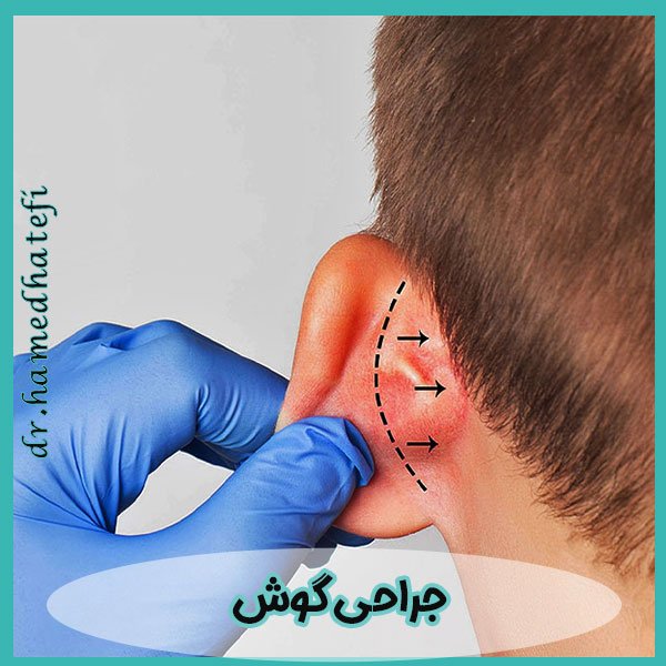 جراحی گوش