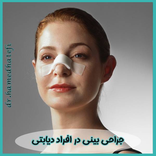 جراحی بینی در افراد دیابتی - https://drhatefi.com/