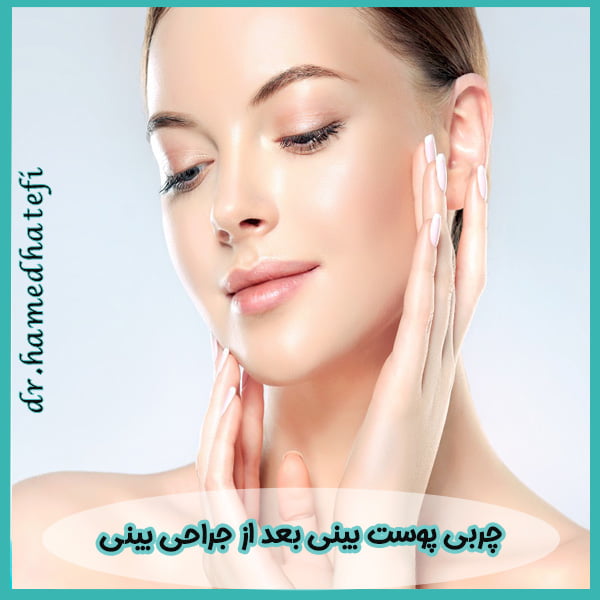 چربی پوست بینی بعد از جراحی بینی - https://drhatefi.com/