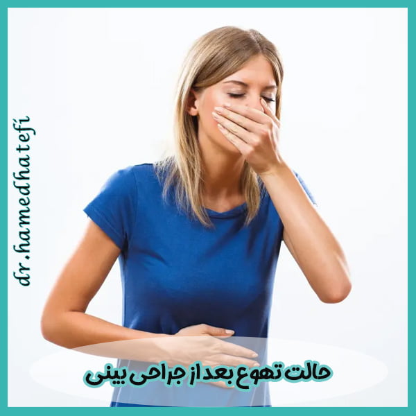 حالت تهوع بعد از جراحی بینی - https://drhatefi.com/