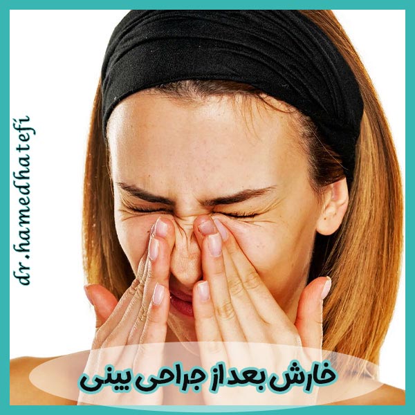 خارش بعد از جراحی بینی