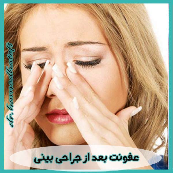 عفونت بعد از جراحی بینی