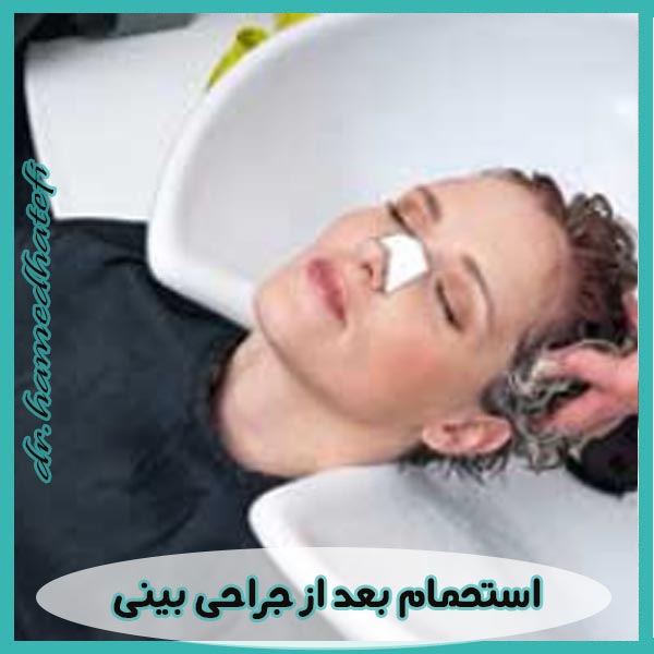 استحمام بعد از جراحی بینی