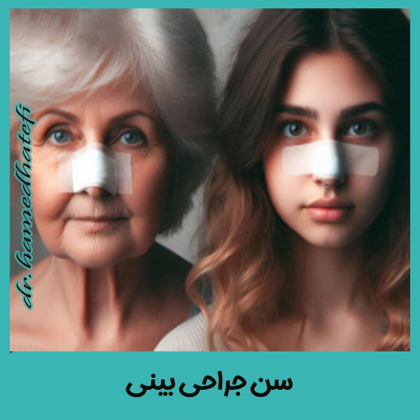 سن جراحی بینی