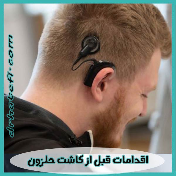اقدامات قبل از کاشت حلزون