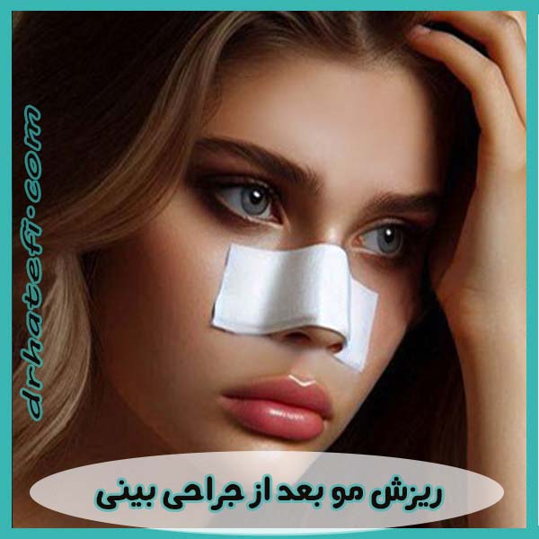 ریزش مو بعد از جراحی بینی