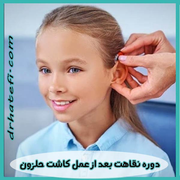 دوره نقاهت بعد از عمل کاشت حلزون _ دکتر حامد هاتفی