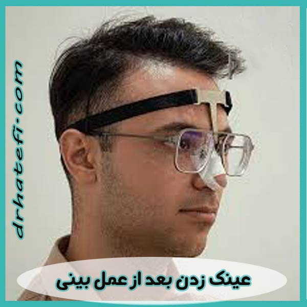 عینک زدن بعد از عمل بینی