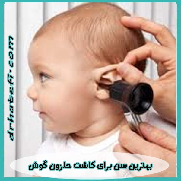بهترین سن برای کاشت حلزون گوش