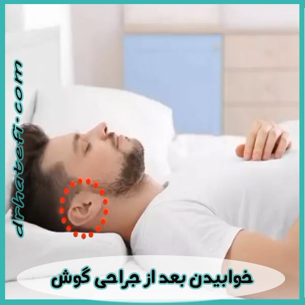 خوابیدن بعد از جراحی گوش