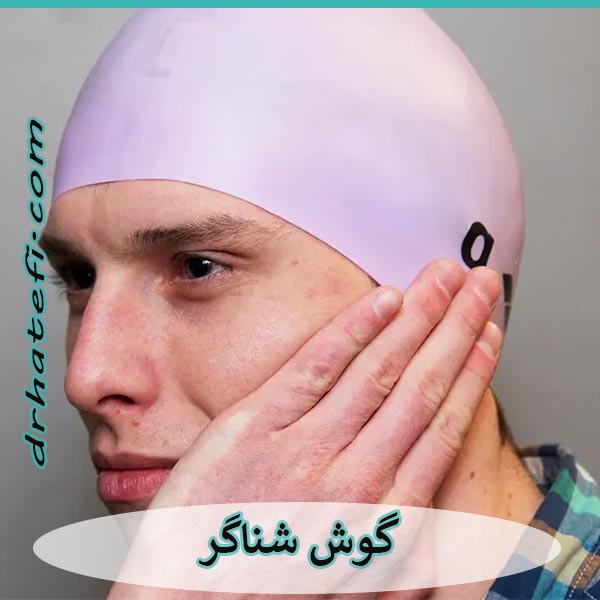 بیماری گوش شناگر _ دکتر حامد هاتفی