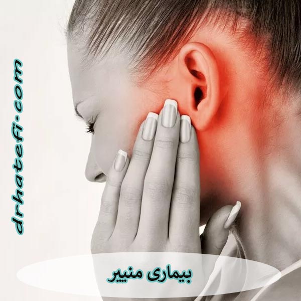 بیماری منییر گوش _ دکتر حامد هاتفی